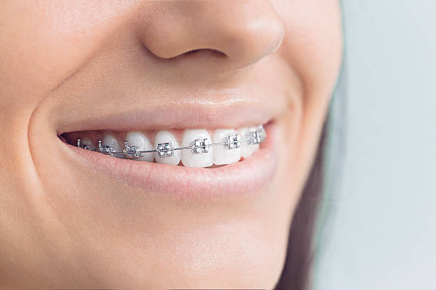 Best Dental Fillings (Composite and Amalgam)  in Vega, TX